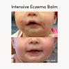 imageEvereden Healing Eczema Treatment 17 fl oz  Eczema Cream  Clean and Fragrance Free Cream for Babies Kids and Adults  FSA EligibleBalm